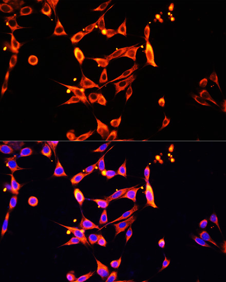 Heparanase 1 Rabbit Polyclonal Antibody - Image 3