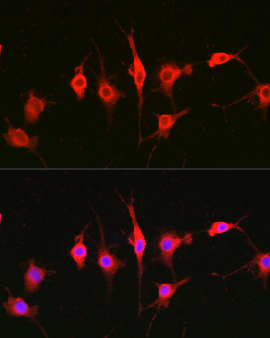 Heparanase 1 Rabbit Polyclonal Antibody - Image 2