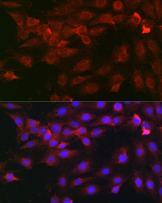 Heparanase 1 Rabbit Polyclonal Antibody - Image 3