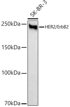 HER2/ErbB2 Rabbit Monoclonal Antibody