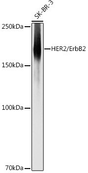 HER2/ErbB2 Rabbit Polyclonal Antibody