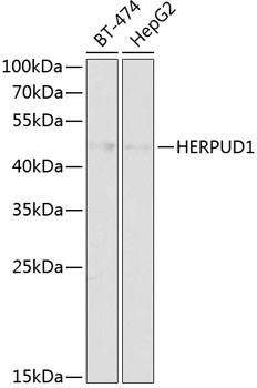 HERPUD1 Rabbit Polyclonal Antibody