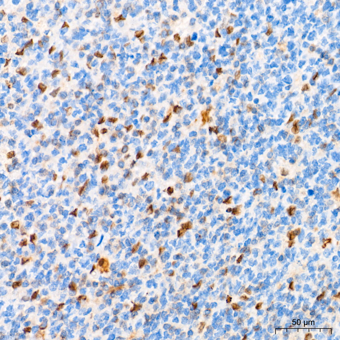 HES1 Rabbit Monoclonal Antibody - Image 3