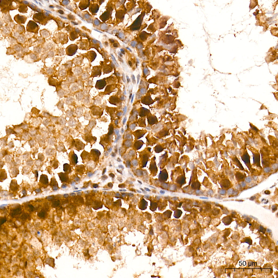 HES5 Rabbit Monoclonal Antibody - Image 2