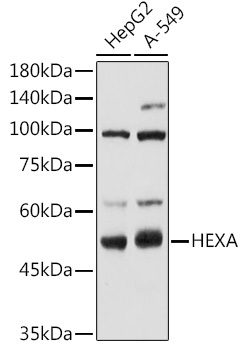 HEXA Rabbit Polyclonal Antibody