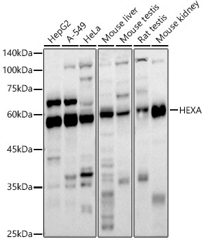HEXA Rabbit Polyclonal Antibody