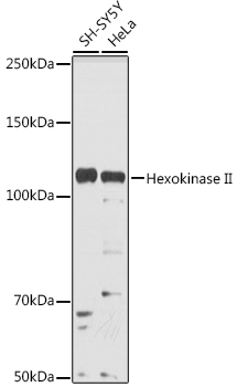 Hexokinase II Rabbit Polyclonal Antibody - Image 2