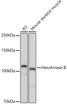 Hexokinase II Rabbit Polyclonal Antibody