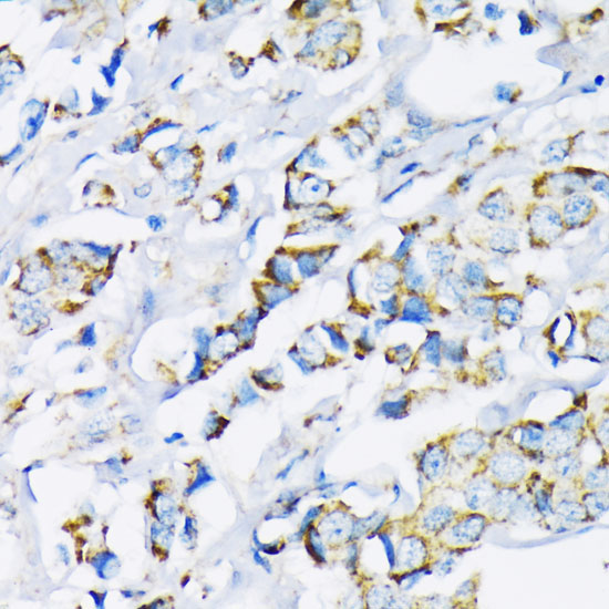 Hexokinase II Rabbit Polyclonal Antibody - Image 2