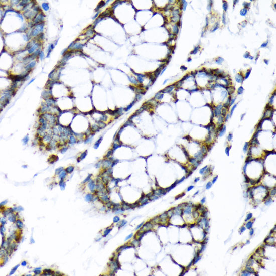 Hexokinase II Rabbit Polyclonal Antibody - Image 3