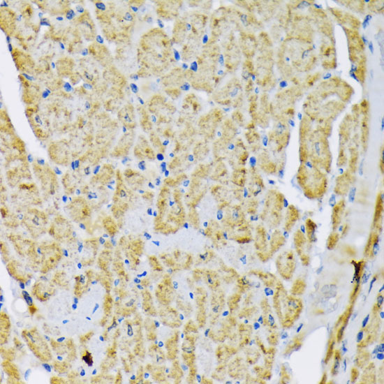 Hexokinase II Rabbit Polyclonal Antibody - Image 4