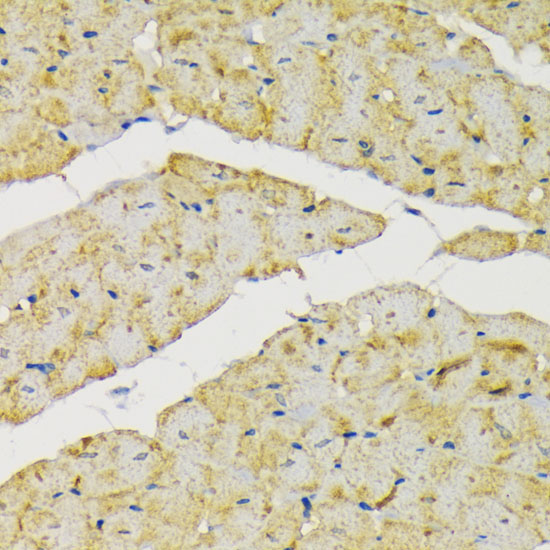 Hexokinase II Rabbit Polyclonal Antibody - Image 5