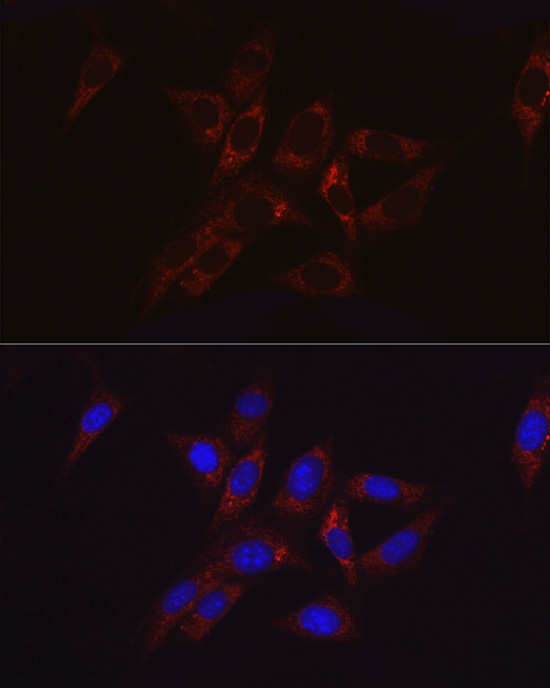 Hexokinase II Rabbit Polyclonal Antibody - Image 6