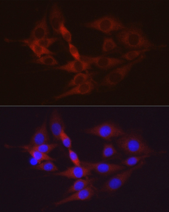 Hexokinase II Rabbit Polyclonal Antibody - Image 7