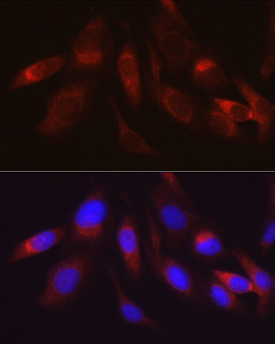 Hexokinase II Rabbit Polyclonal Antibody - Image 8