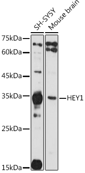HEY1 Rabbit Polyclonal Antibody