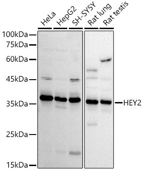 HEY2 Rabbit Polyclonal Antibody