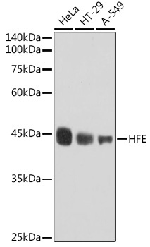 HFE Rabbit Monoclonal Antibody