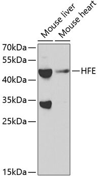HFE Rabbit Polyclonal Antibody