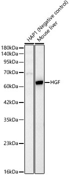 HGF Rabbit Polyclonal Antibody