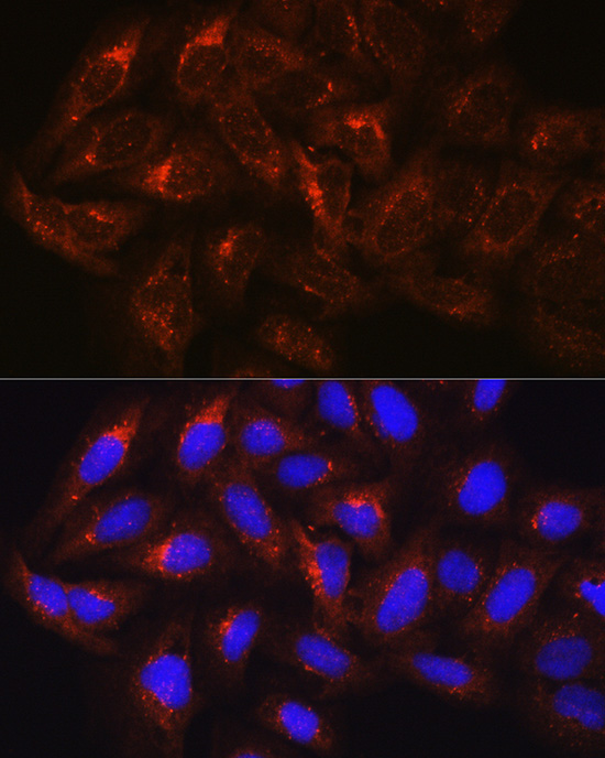 HGS Rabbit Polyclonal Antibody - Image 2