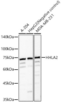 HHLA2 Rabbit Polyclonal Antibody