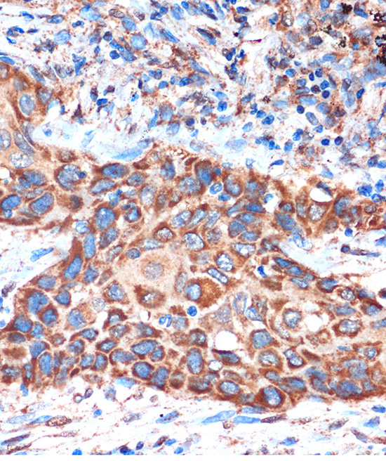 HIBADH Rabbit Polyclonal Antibody - Image 2