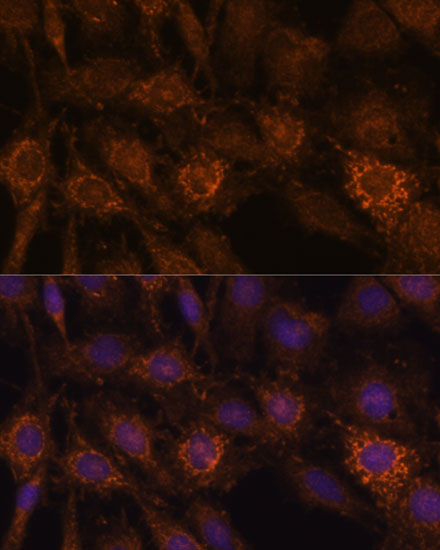 HIBADH Rabbit Polyclonal Antibody - Image 4
