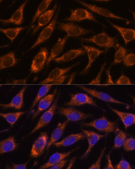 HIBADH Rabbit Polyclonal Antibody - Image 5