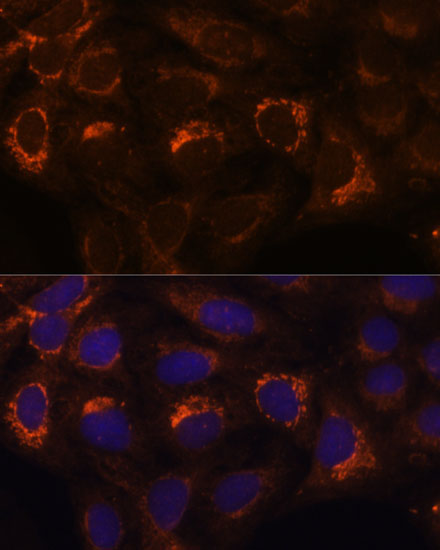 HIBADH Rabbit Polyclonal Antibody - Image 6