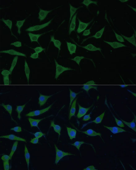 HIBCH Rabbit Polyclonal Antibody - Image 2