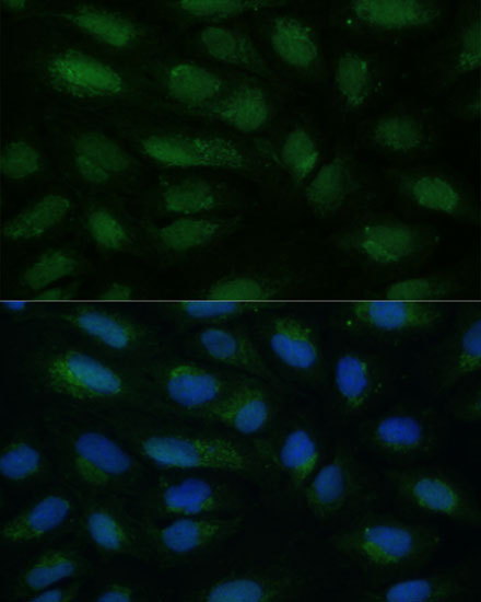 HIBCH Rabbit Polyclonal Antibody - Image 3