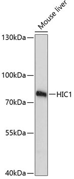 HIC1 Rabbit Polyclonal Antibody