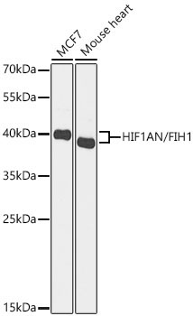 HIF1AN/FIH1 Rabbit Polyclonal Antibody