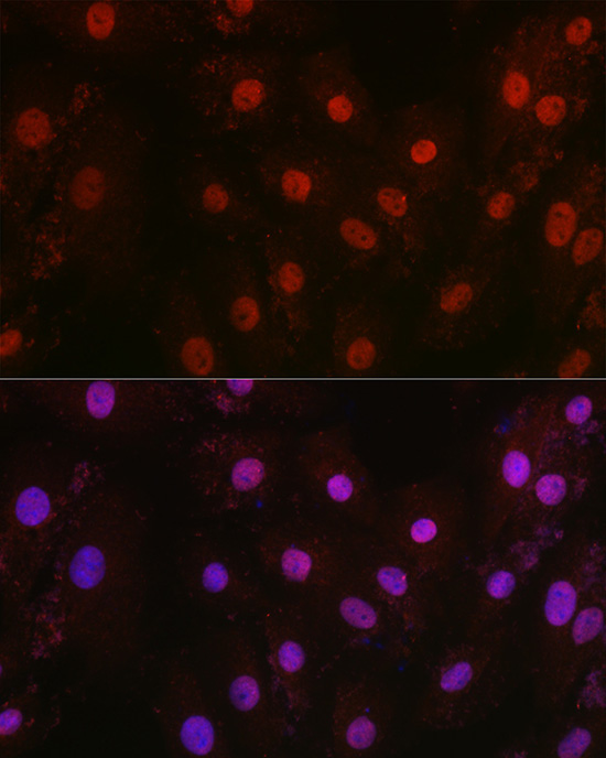 HIF1Beta/ARNT Rabbit Polyclonal Antibody