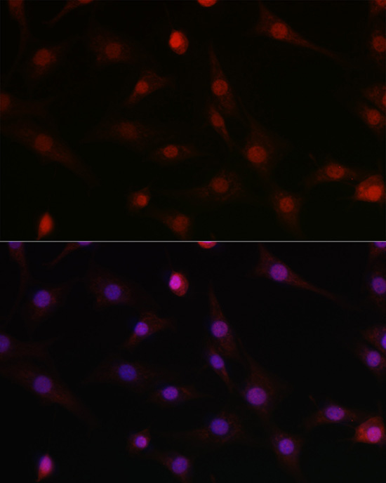 HIF1Beta/ARNT Rabbit Polyclonal Antibody - Image 2
