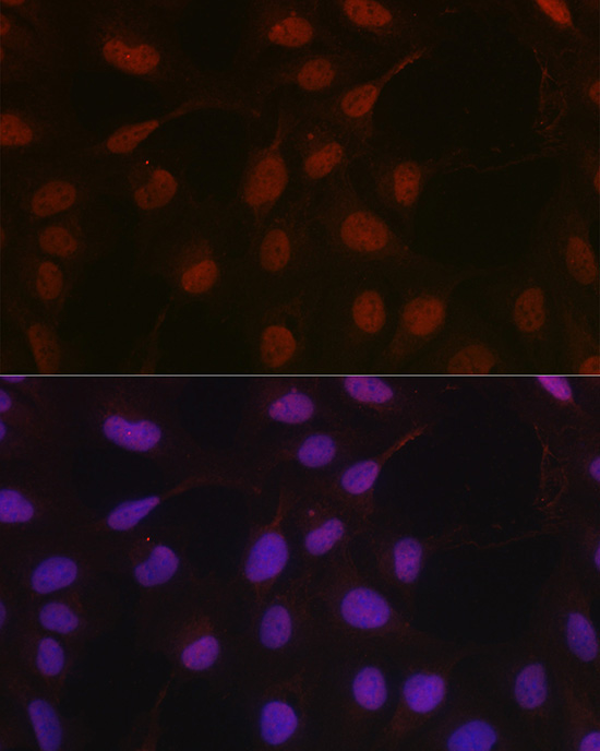 HIF1Beta/ARNT Rabbit Polyclonal Antibody - Image 3