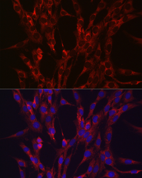 HIF3A Rabbit Polyclonal Antibody - Image 2