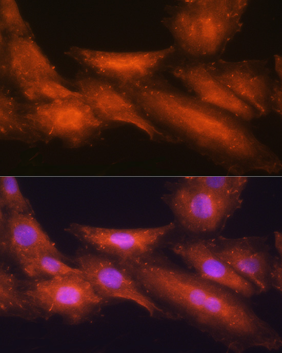 HINT1 Rabbit Polyclonal Antibody - Image 2