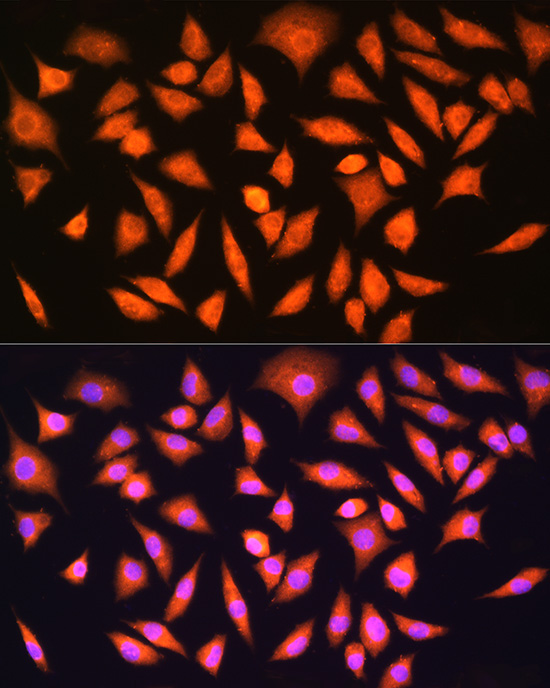 HINT1 Rabbit Polyclonal Antibody - Image 3