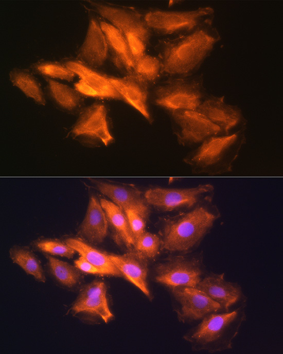 HINT1 Rabbit Polyclonal Antibody - Image 2