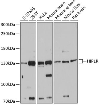 HIP1R Rabbit Polyclonal Antibody