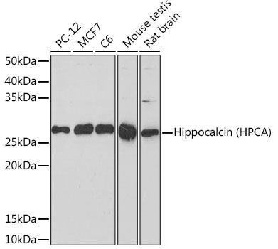 Hippocalcin (HPCA) Rabbit Monoclonal Antibody