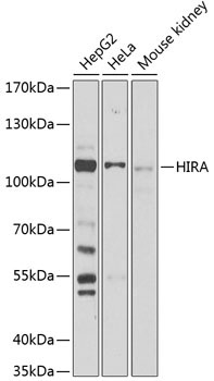 HIRA Rabbit Polyclonal Antibody