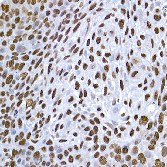 HIST1H1C Rabbit Polyclonal Antibody