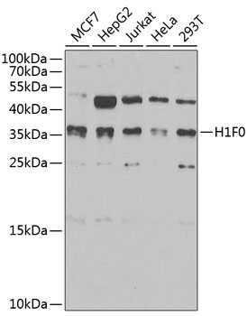 Histone H1.0 Rabbit Polyclonal Antibody