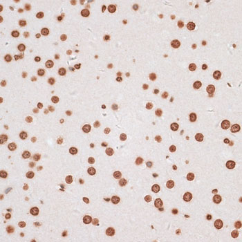 Histone H2AX Rabbit Polyclonal Antibody - Image 4