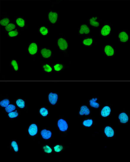 Histone H2AX Rabbit Polyclonal Antibody - Image 6