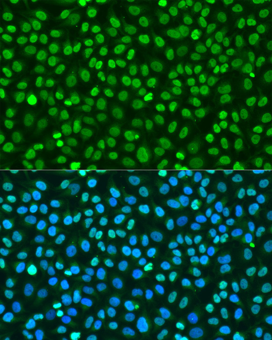 Histone H2AX Rabbit Polyclonal Antibody - Image 7