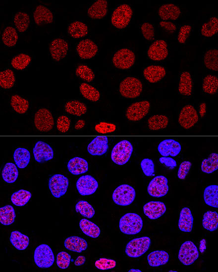 Histone H2AX Rabbit Polyclonal Antibody - Image 5